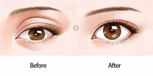 邯鄲哪家醫(yī)院能夠有效改善厚唇問題？如何選擇醫(yī)院？