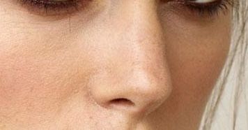 西安哪家醫(yī)院治療雙眼皮效果專業(yè)？達(dá)人推薦，好口碑！