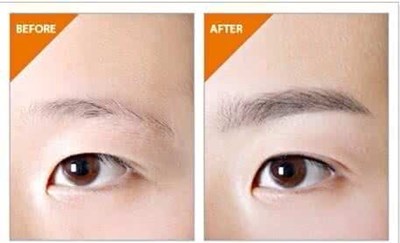 華西醫(yī)院整形外科靠譜嗎？手術(shù)費(fèi)用和?？凭ǖ目剖矣心男?？