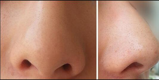 上海九院整形科怎么掛號預(yù)約？只需簡單幾步，輕松解決！