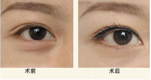 【獨(dú)家】上海九院整形科醫(yī)生王琛醫(yī)生的專長與案例分享