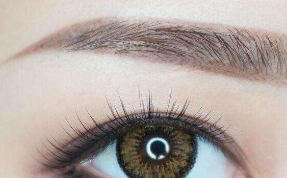 徐州市王瑩醫(yī)療美容院雙眼皮整形效果如何？實測案例分享