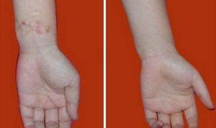 重慶暢美吸脂減肥醫(yī)院：革新技術(shù)引領(lǐng)行業(yè)，成就完美曲線