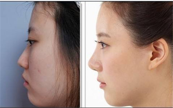 常州市中醫(yī)院是一家有哪些優(yōu)勢的醫(yī)美整形醫(yī)院呢