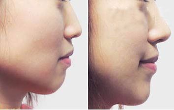 珠海采用新技術(shù)，瞬間消除黑眼圈的專業(yè)美容醫(yī)院預(yù)約