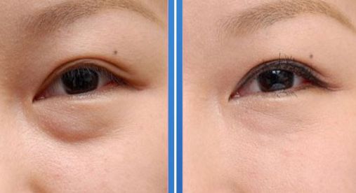 西安祛斑醫(yī)院綜合排行榜公開，全面解析正規(guī)專業(yè)醫(yī)院推薦