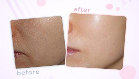 上海伯思立整形：查看整形醫(yī)生列表與成功案例