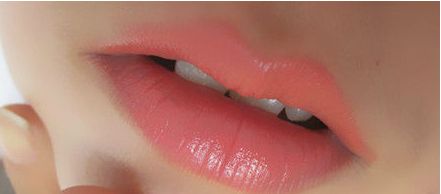 秦皇島頂級(jí)醫(yī)院一次雙眼皮手術(shù)價(jià)格揭秘，專家推薦+真實(shí)案例告訴你！