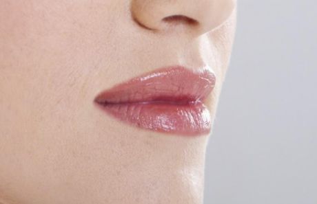 廣醫(yī)一院整形美容科：醫(yī)生實(shí)力強(qiáng)，雙眼皮案例為佐證