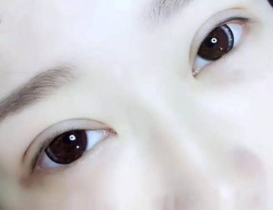 探秘秦皇島醫(yī)療機(jī)構(gòu)，深度了解雙眼皮手術(shù)的影響及推薦醫(yī)生星級(jí)！