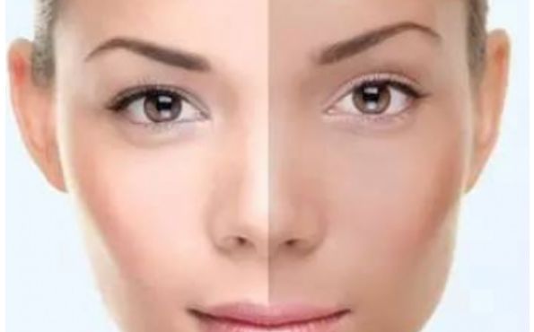 長沙醫(yī)療機構(gòu)優(yōu)質(zhì)整鼻手術(shù)服務(wù)