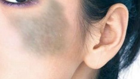 鎮(zhèn)江隆鼻醫(yī)院推薦：鎮(zhèn)江做隆鼻，這幾家醫(yī)院不可錯(cuò)過！