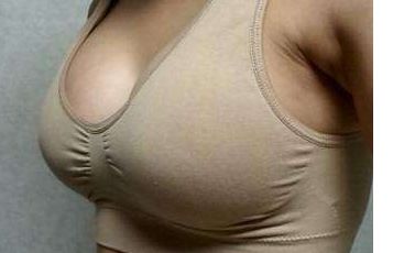 朱海男雙眼皮手術(shù)效果及經(jīng)驗分享！是否可信賴？面臨怎樣的結(jié)果？趕緊探究吧！