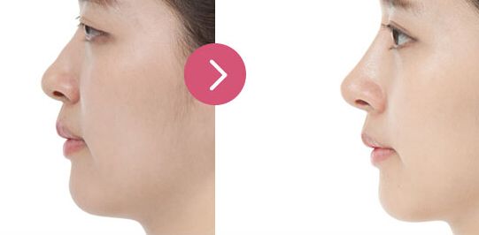 北京大學口腔醫(yī)院優(yōu)秀正畸科醫(yī)生推薦！