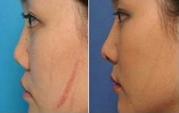 蘇州最佳雙眼皮整形醫(yī)生TOP5：專業(yè)推薦！