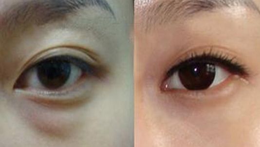 金華醫(yī)療機(jī)構(gòu)榜單：自體耳軟骨隆鼻治療前五名推薦