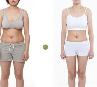 廣州去疤整形醫(yī)院排名前三公布，醫(yī)療界為之驚嘆！