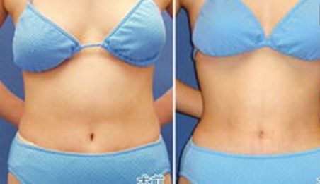 衡陽比較好的醫(yī)院美容科專家團隊推薦，價格公開透明！