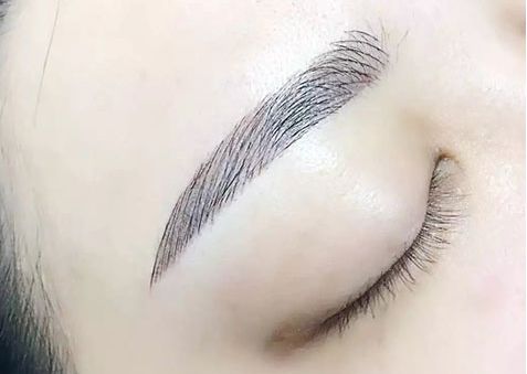 激光煥膚中心：祛眼袋效果有口皆碑，多位專家力薦