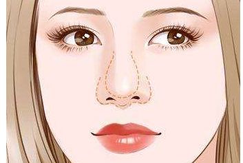 濟(jì)南哪家醫(yī)生做雙眼皮效果好？謝燕燕醫(yī)生實(shí)力及案例揭秘！