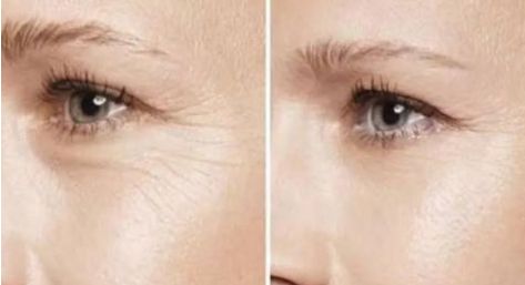 2023最佳杭州雙眼皮整形醫(yī)院排行榜揭曉！讓你雙眼瞬間變迷人的十大選擇！