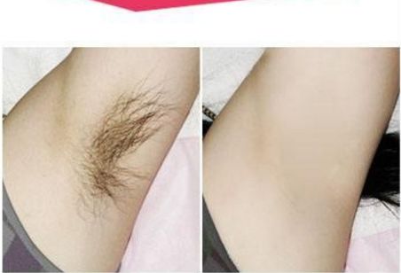 鄭大一附院整形科：專家門診時間及預(yù)約價目參考