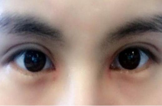 專(zhuān)家執(zhí)針絕活，您知道哪位醫(yī)生在注射物取出方面最厲害嗎？獨(dú)特手法排行榜前五名大揭曉