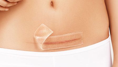 上海九院王琛隆鼻術后圖及專家簡介，完成理想的鼻梁不再遙不可及！