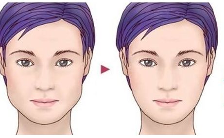 上海著名整形醫(yī)生李圣利的鼻子審美效果如何？網(wǎng)友親身經(jīng)歷分享實例。