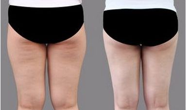 上海頂尖整容醫(yī)師團(tuán)隊(duì)曝光：專為改善臉型而生！