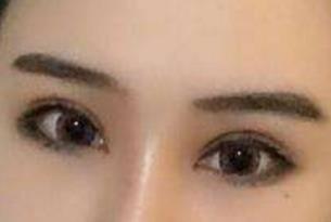 成都大華整形醫(yī)院醫(yī)生有哪些擅長項(xiàng)目？醫(yī)院技術(shù)如何？