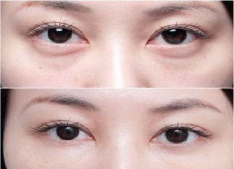 杭州專業(yè)整容醫(yī)療機構(gòu)排行榜大揭秘！藝術(shù)之星醫(yī)療集團對比時光整形大賽！真實原因還原無遺！