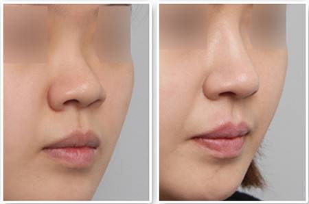 廣州愛來醫(yī)療美容門診部口碑怎么樣？醫(yī)院醫(yī)生和地址如何？門診部真的靠譜嗎？