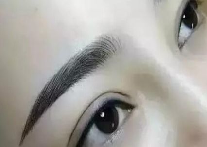 選擇最適合您的雙眼皮手術(shù)醫(yī)院-專(zhuān)業(yè)的推薦