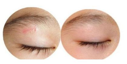 長沙翹臀整形專家推薦美容醫(yī)院-哪家更好？