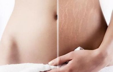 浙江知名隆胸醫(yī)院推薦！這些醫(yī)院廣受好評(píng)