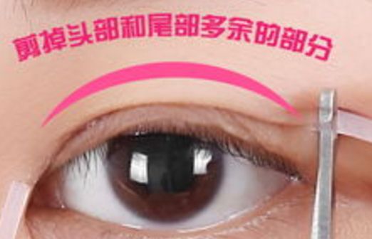 樂(lè)山市人民醫(yī)院眼袋手術(shù)口碑如何？醫(yī)生推薦+真實(shí)案例分析