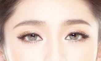 石家莊美聯(lián)臣雙眼皮整形靠譜嗎？有哪些優(yōu)秀醫(yī)生？有什么成功案例供參考？