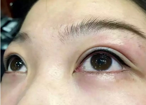 長(zhǎng)沙愛思特整形醫(yī)院口碑如何？全新隆胸恢復(fù)過程親體驗(yàn)到底值不值得參考？