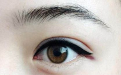 南寧醫(yī)科大雙眼皮整形費(fèi)用及技術(shù)綜述！名單與收費(fèi)指南分享