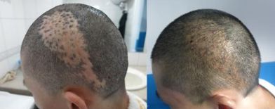 杭州有哪些專(zhuān)業(yè)技術(shù)過(guò)硬的鼻修復(fù)醫(yī)院？推薦浙江第二醫(yī)院、薇琳整形醫(yī)院、清鍇醫(yī)療美容中心等