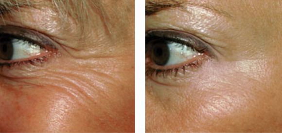 深圳最佳醫(yī)療機構排名，熱瑪吉治療哪家醫(yī)院效果好？