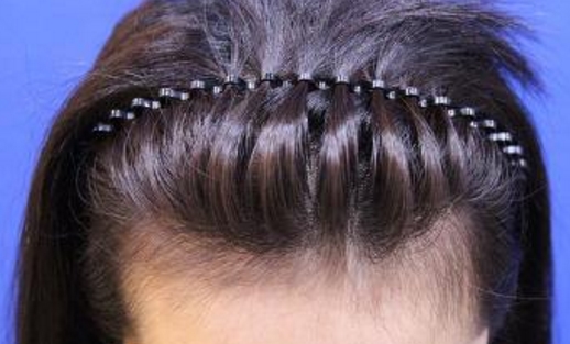 武漢美成醫(yī)療美容醫(yī)院醫(yī)生技術(shù)真的靠譜嗎？誰可以給出點評？