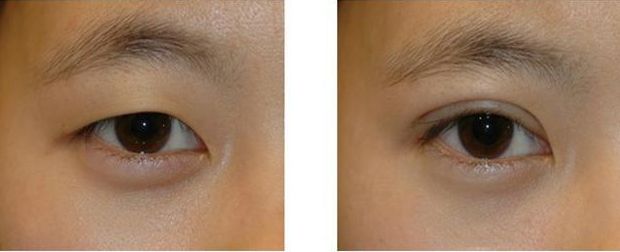 趙天蘭個(gè)人信息揭秘！她現(xiàn)在工作于哪家醫(yī)療中心？揭秘操作實(shí)例帶來新的啟示