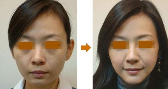 國內(nèi)口碑推薦的下頜角手術(shù)醫(yī)院，上海和武漢地區(qū)有哪些知名醫(yī)院？