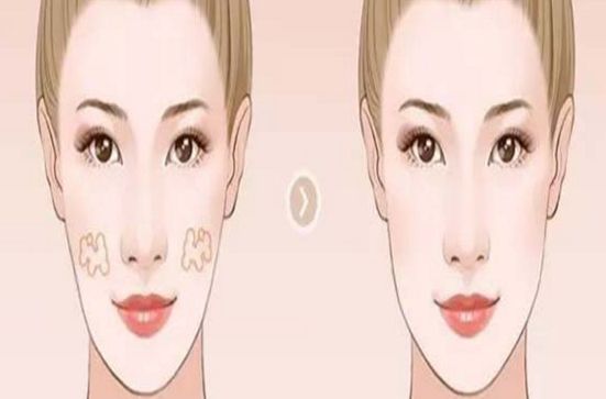 鄭州專業(yè)隆鼻醫(yī)生推薦！這幾位技術(shù)嫻熟，信譽(yù)口碑不容錯(cuò)過