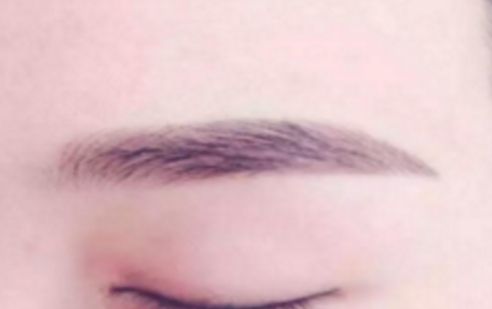 大連有哪家醫(yī)院是做鼻子手術(shù)的佼佼者？強力推薦，值得分享！