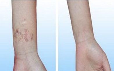 2023年武漢脫發(fā)治療獨家名單曝光！醫(yī)術(shù)嫻熟，聲譽遙遙領(lǐng)先！