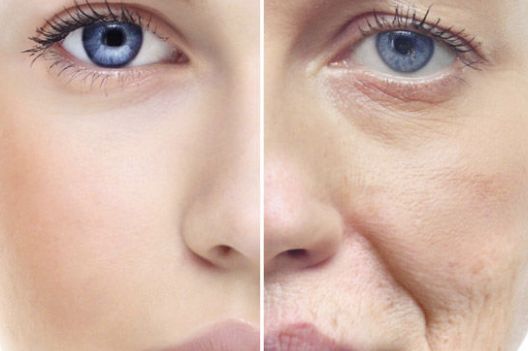 哈醫(yī)大一院陳偉華醫(yī)生成功修復雙眼皮的治療方式揭秘，2023實例公開！