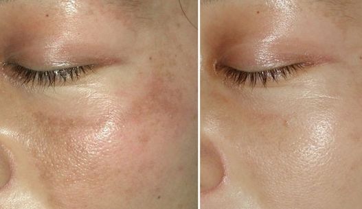 南充優(yōu)質(zhì)眼部整容醫(yī)生推薦，專家級(jí)名醫(yī)榜單發(fā)布